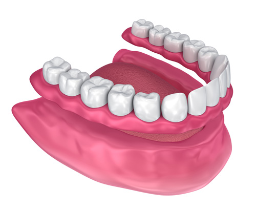 Removable Dentures