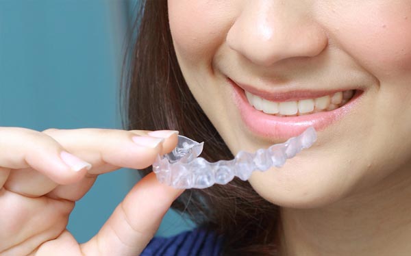 Invisalign Tray