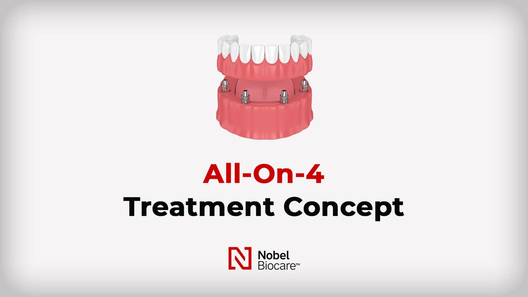 All on 4 Treatment Concept Video